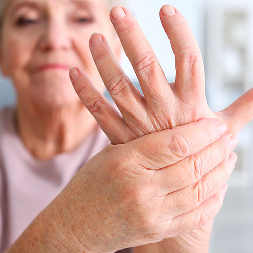Чем лечить артроз пальцев и кистей рук